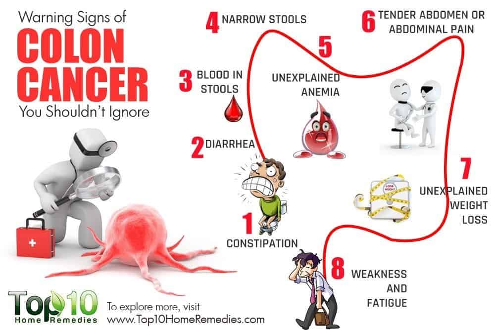 13 Early Warning Signs Of Colon Cancer You Should not Ignore